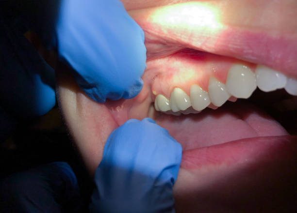 Best Tooth Pain Emergency Relief  in Derby, KS