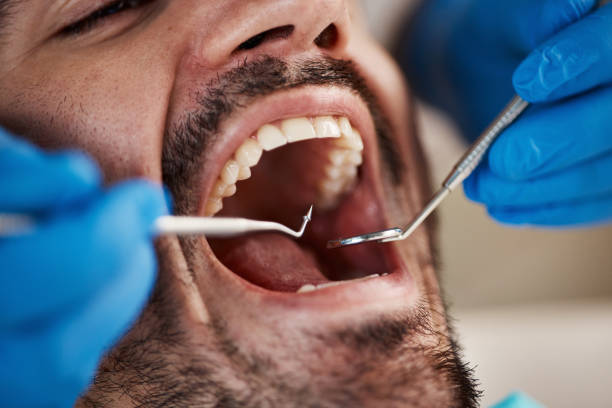 Best Knocked-Out Tooth Emergency  in Derby, KS